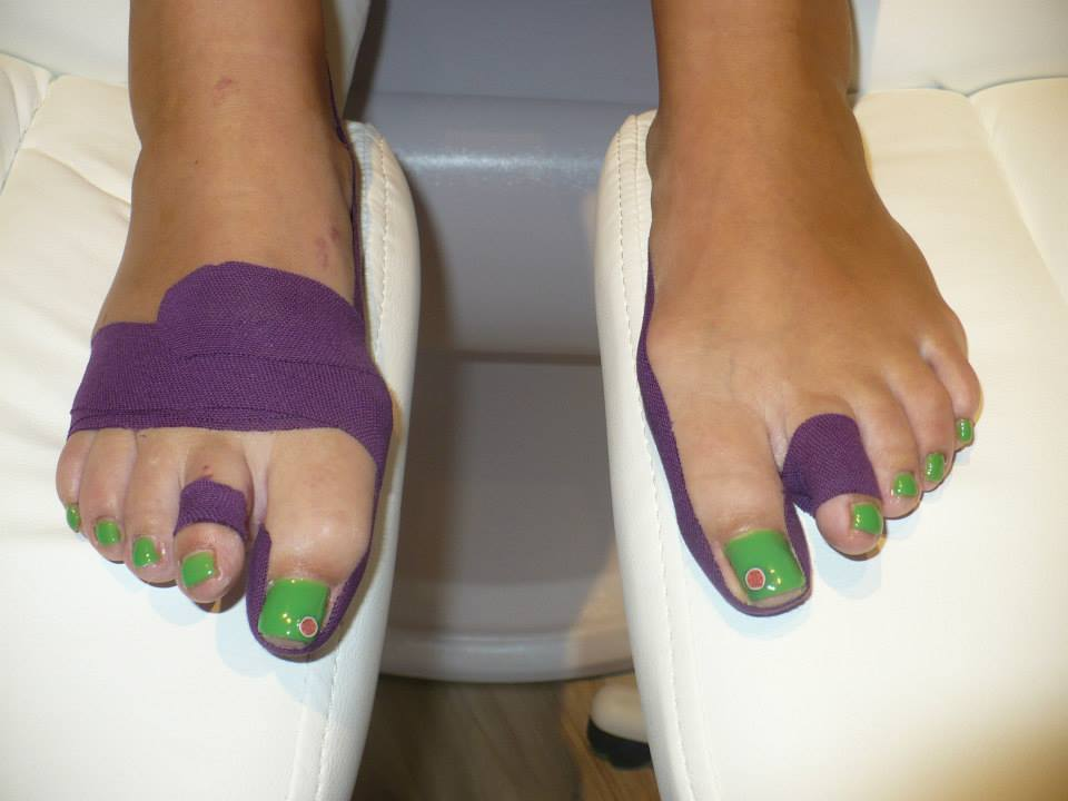 Medicinální pedikúra. Cnd Shellac.Tejpování haluxu